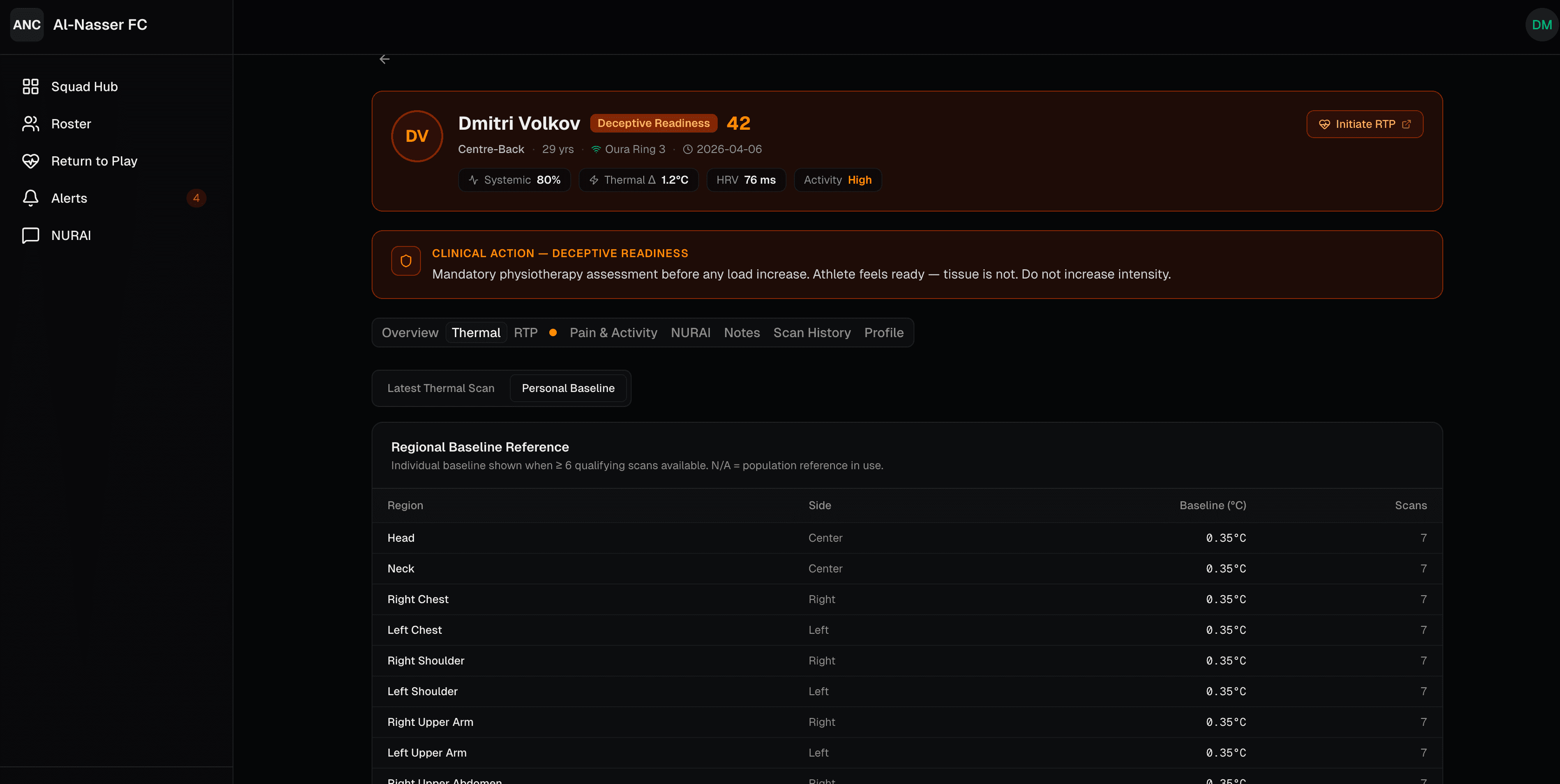 Personal Baseline: Regional Baseline Reference per athlete